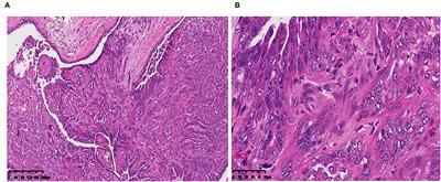 Establishment of a New Cell Line of Canine Mammary Tumor CMT-1026